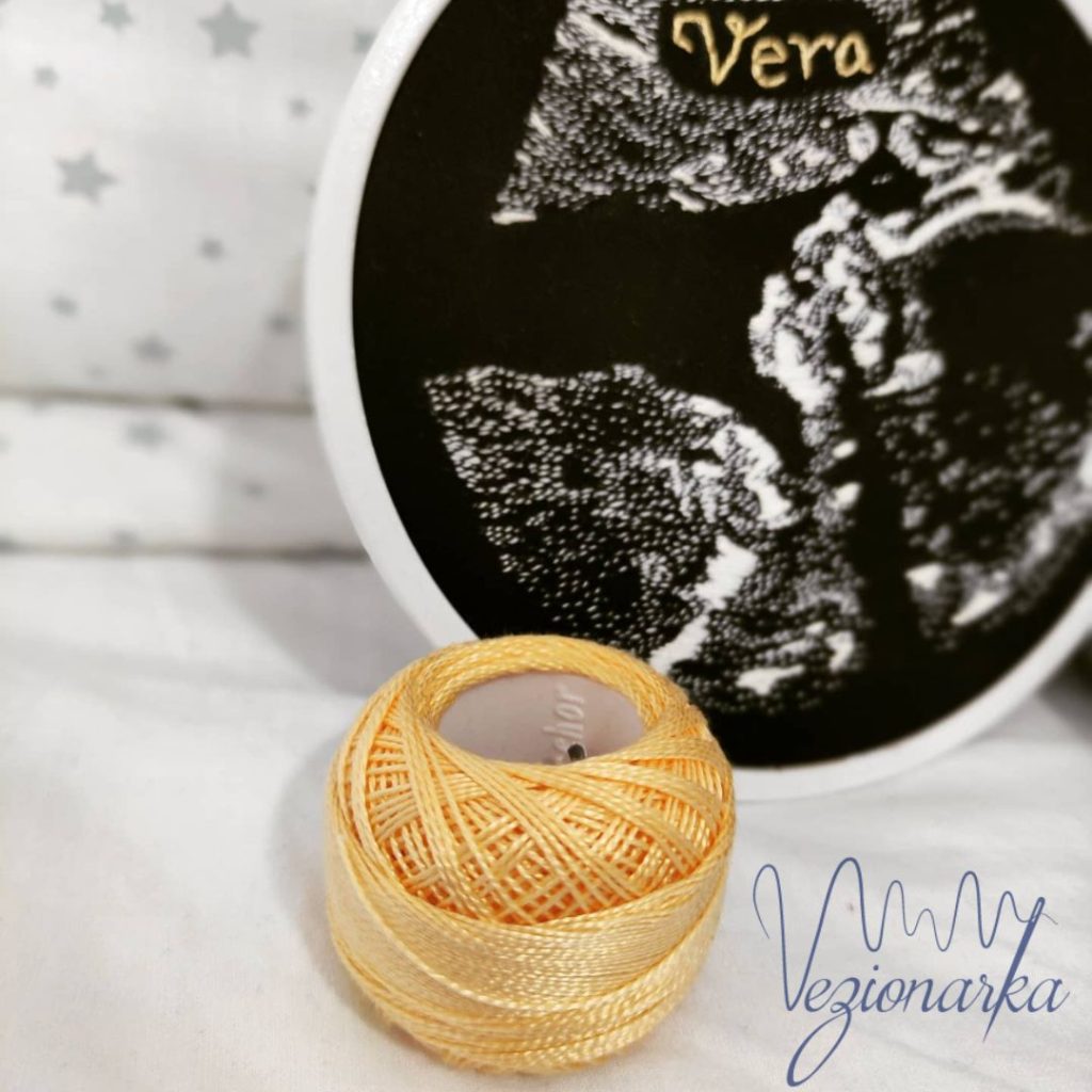 Vez ultrazvuka okrugli ram (21) Poklon - vez ultrazvuka bebe na platnu