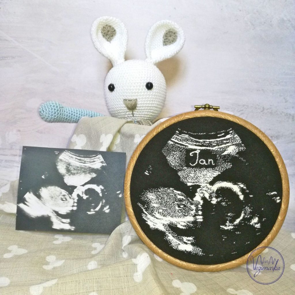 Ultrazvuk na platnu Ultrazvuk na platnu