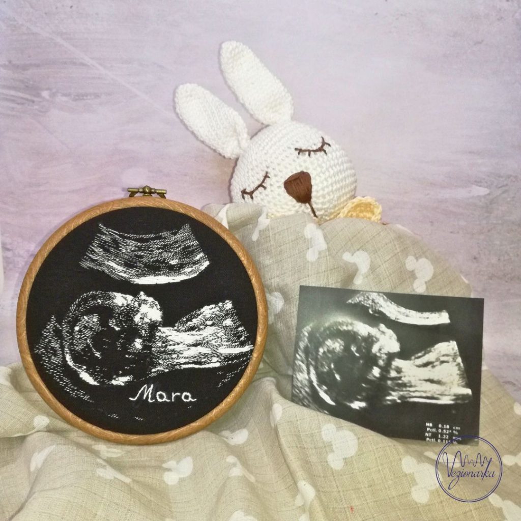 Ultrazvuk na platnu Ultrazvuk na platnu