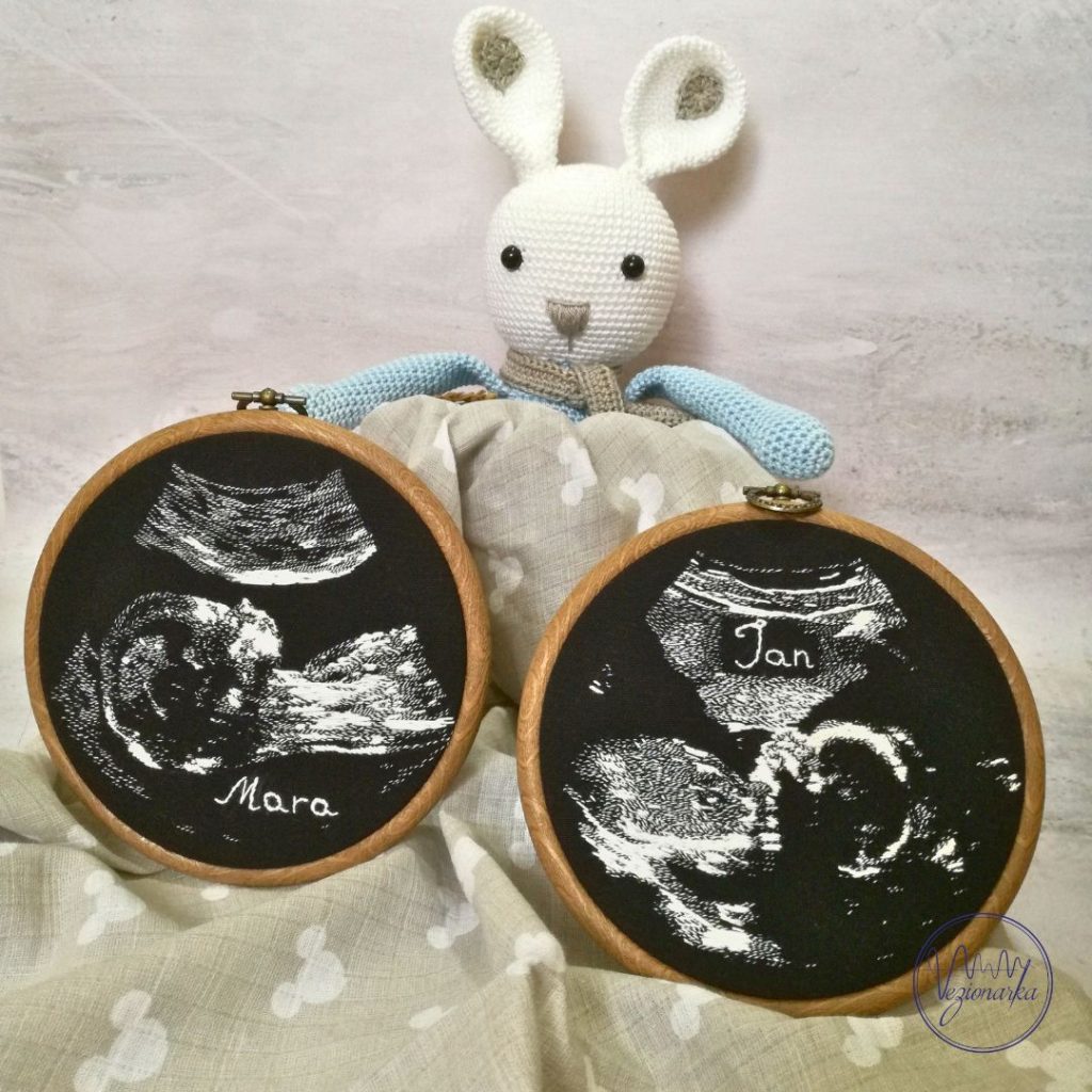 Ultrazvuk na platnu Ultrazvuk na platnu